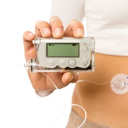 Image for Patient experience - using an insulin pump