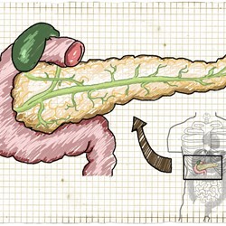 Image for Maturity Onset Diabetes of the Young (MODY)