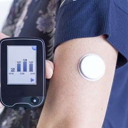 Image for Continuous Glucose Monitoring (CGM)
