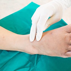 Image for Somerset Foot Service - Low Risk of Developing a Foot Ulcer